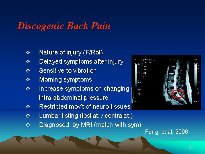 Discogenic Back Pain v v v v Nature of injury (F/Rot) Delayed symptoms after