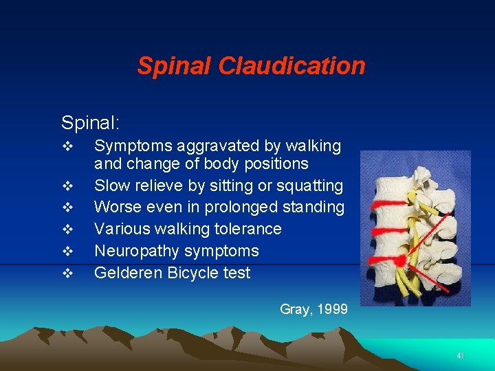 Spinal Claudication Spinal: v v v Symptoms aggravated by walking and change of body