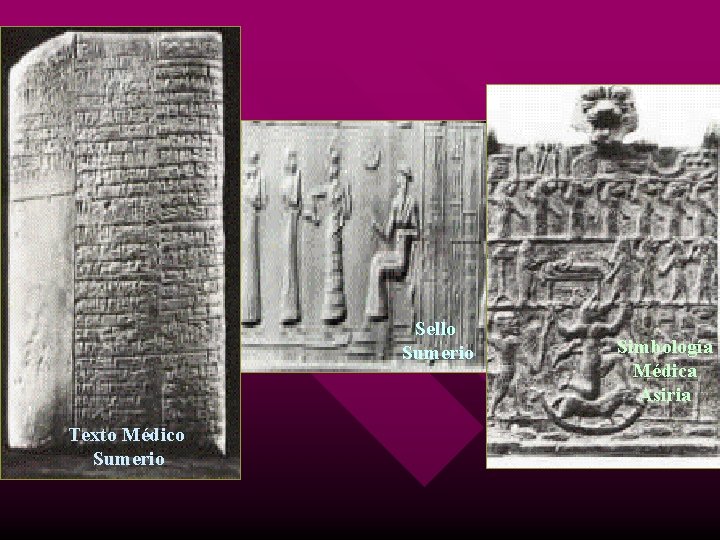 Sello Sumerio Texto Médico Sumerio Simbología Médica Asiria 
