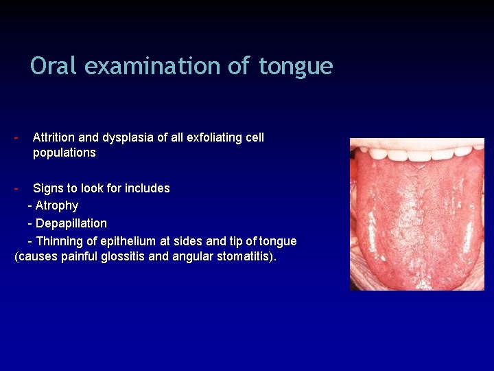 Oral examination of tongue - Attrition and dysplasia of all exfoliating cell populations -