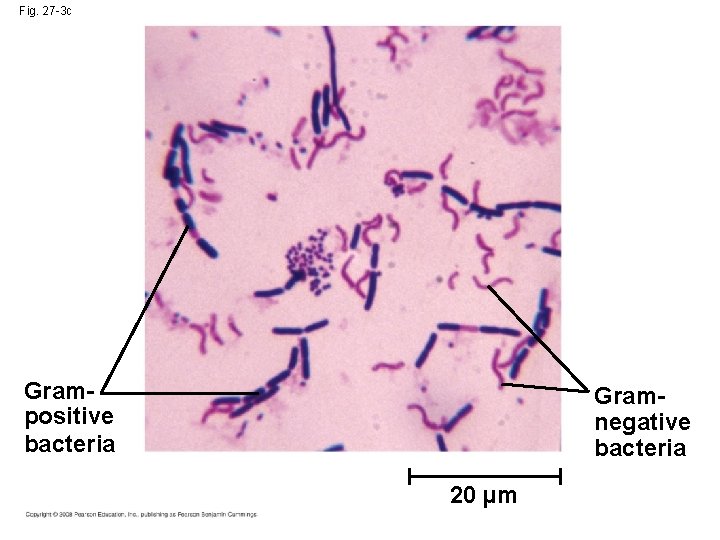 Fig. 27 -3 c Grampositive bacteria Gramnegative bacteria 20 µm 