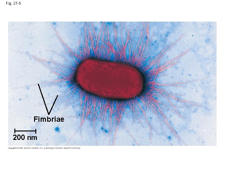 Fig. 27 -5 Fimbriae 200 nm 