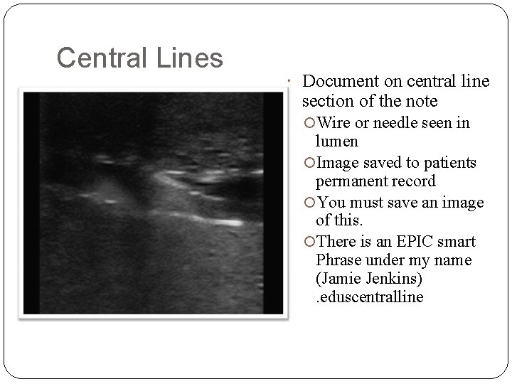 Central Lines Document on central line section of the note Wire or needle seen