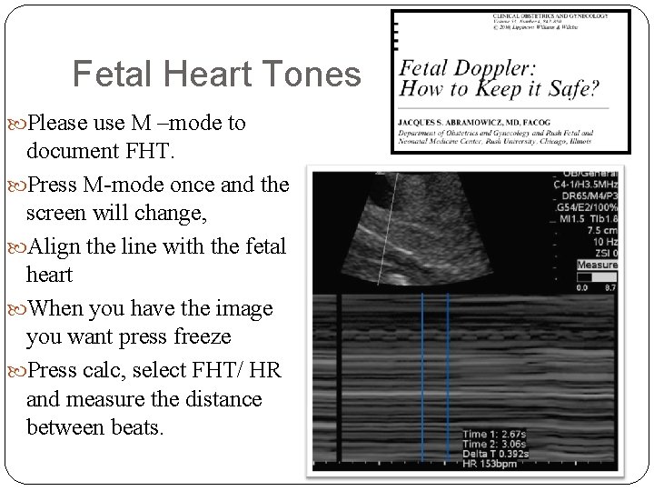 Fetal Heart Tones Please use M –mode to document FHT. Press M-mode once and