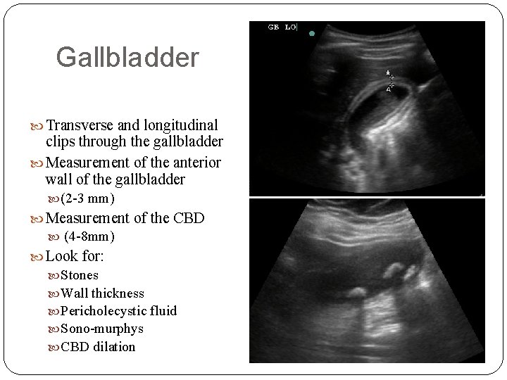 Gallbladder Transverse and longitudinal clips through the gallbladder Measurement of the anterior wall of