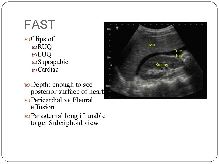 FAST Clips of RUQ LUQ Suprapubic Cardiac Depth: enough to see posterior surface of