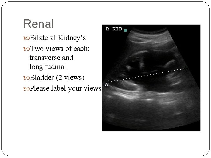 Renal Bilateral Kidney’s Two views of each: transverse and longitudinal Bladder (2 views) Please