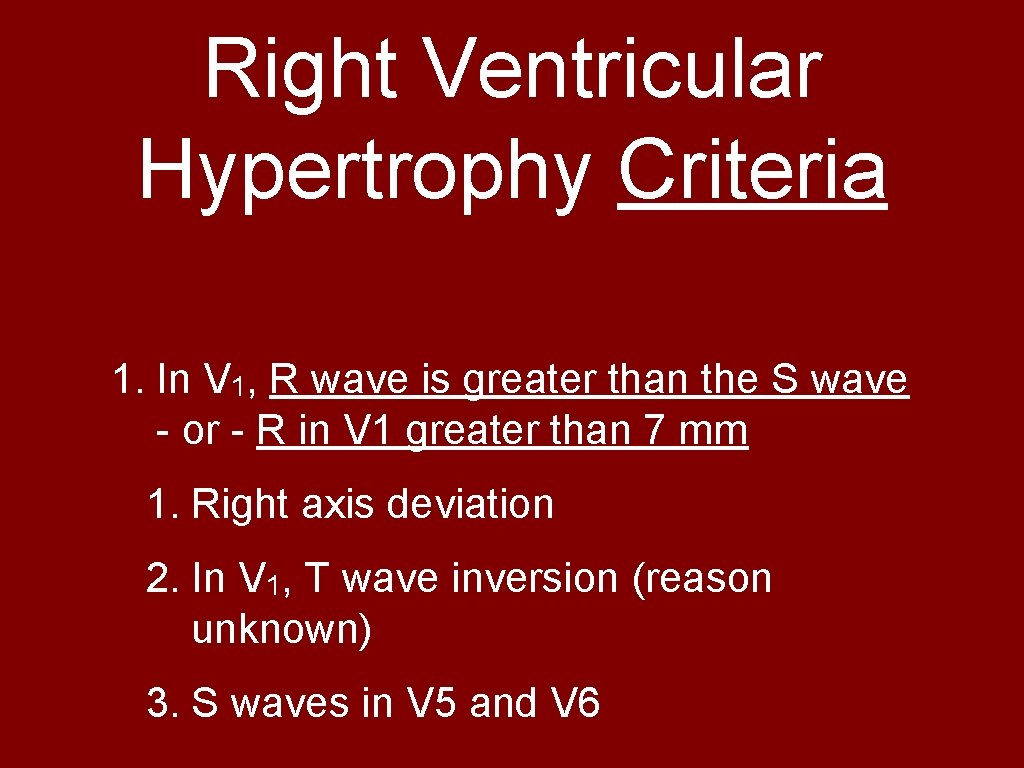 Right Ventricular Hypertrophy Criteria 1. In V 1, R wave is greater than the