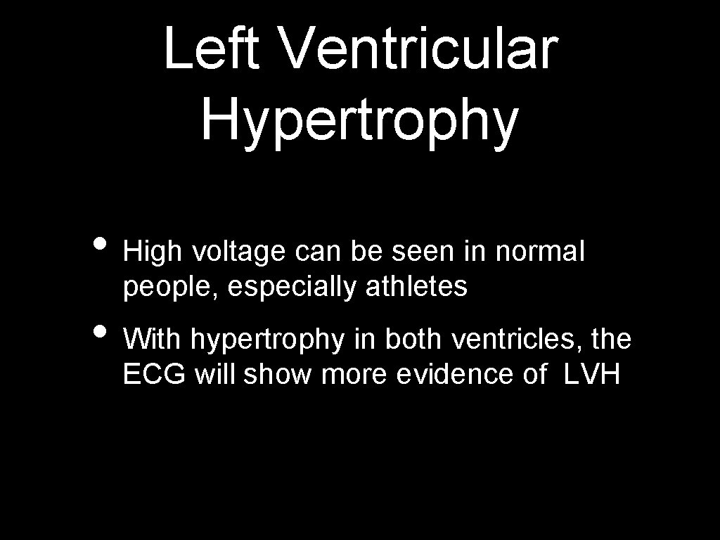 Left Ventricular Hypertrophy • High voltage can be seen in normal people, especially athletes