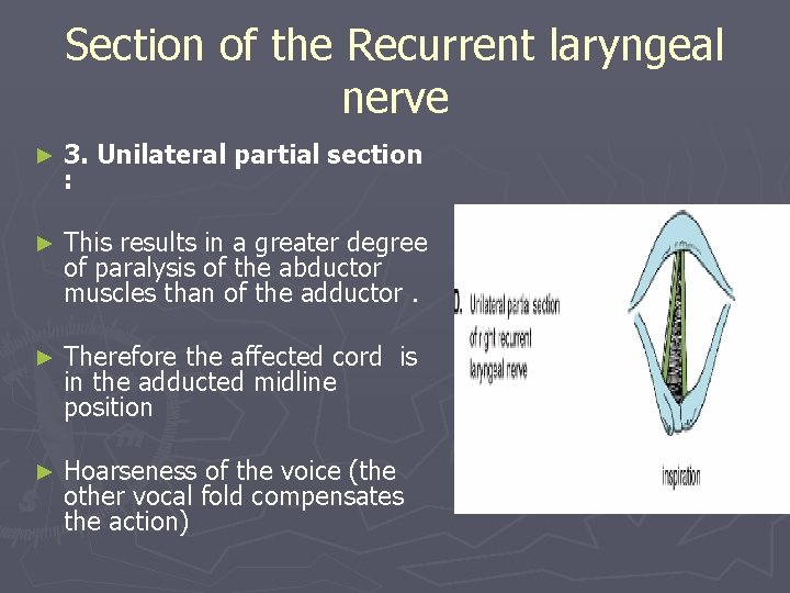 Section of the Recurrent laryngeal nerve ► 3. Unilateral partial section : ► This