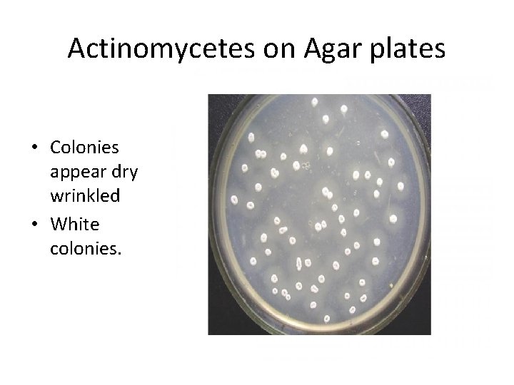 Actinomycetes on Agar plates • Colonies appear dry wrinkled • White colonies. 