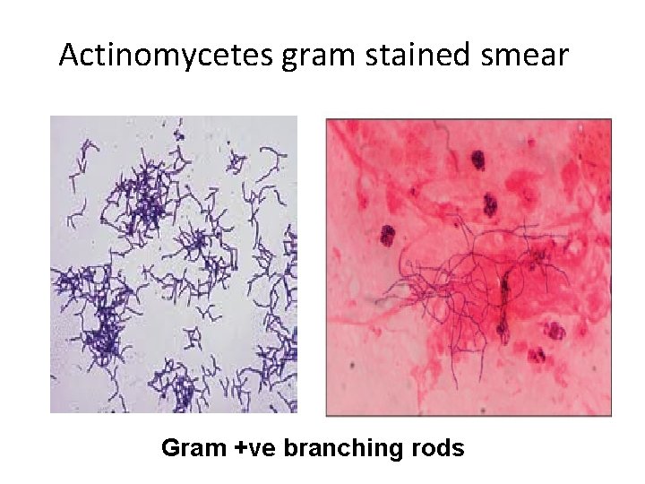 Actinomycetes gram stained smear Gram +ve branching rods 