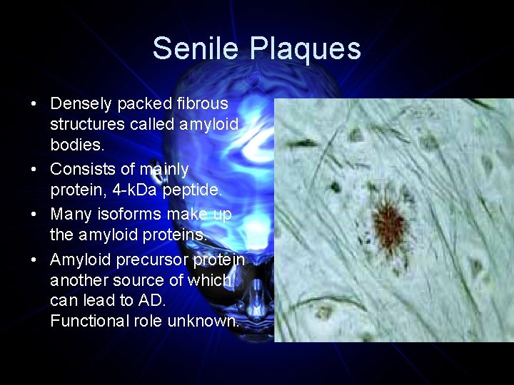 Senile Plaques • Densely packed fibrous structures called amyloid bodies. • Consists of mainly