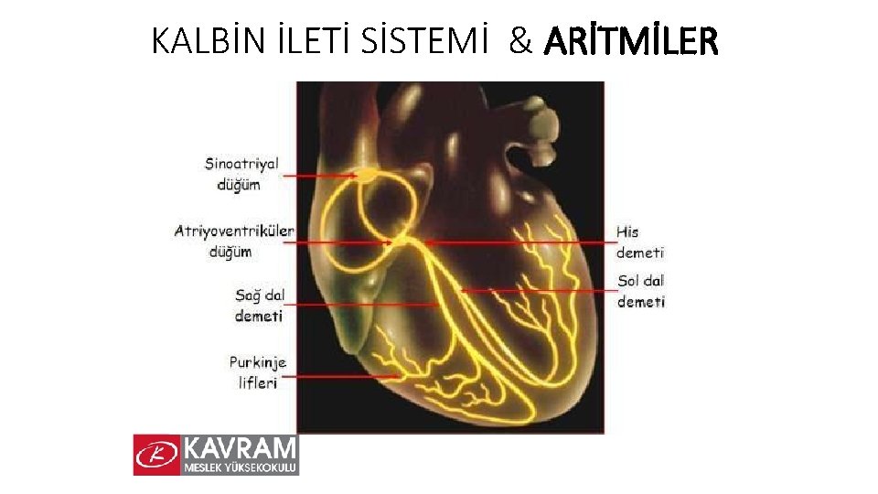 KALBİN İLETİ SİSTEMİ & ARİTMİLER 