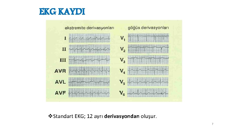 EKG KAYDI v. Standart EKG; 12 ayrı derivasyondan oluşur. 7 
