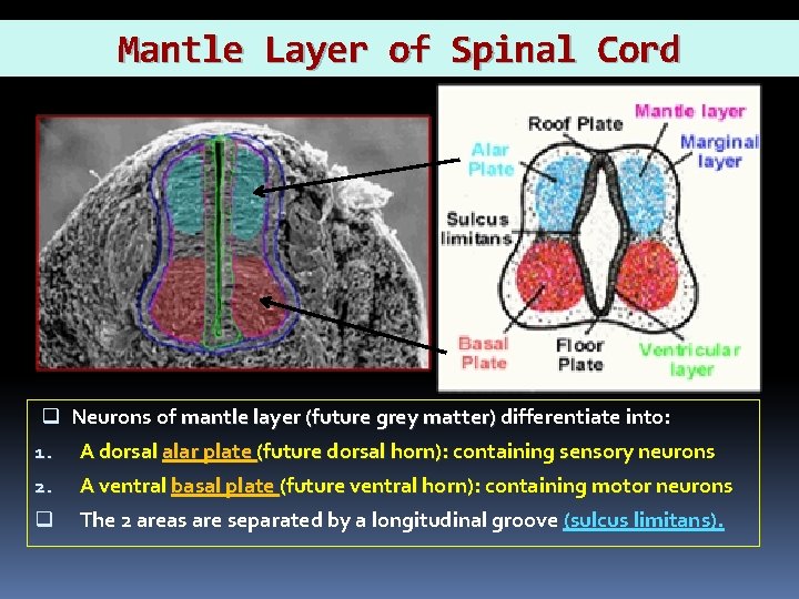 Mantle Layer of Spinal Cord q Neurons of mantle layer laye (future grey matter)