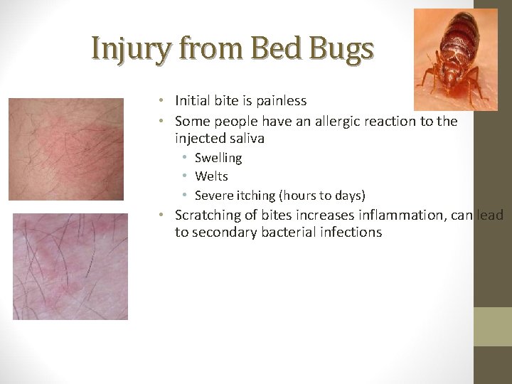 Injury from Bed Bugs • Initial bite is painless • Some people have an