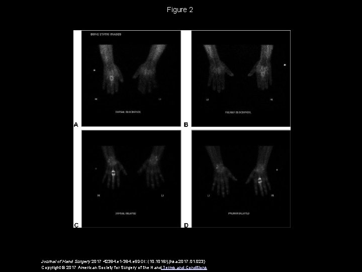 Figure 2 Journal of Hand Surgery 2017 42394. e 1 -394. e 6 DOI: