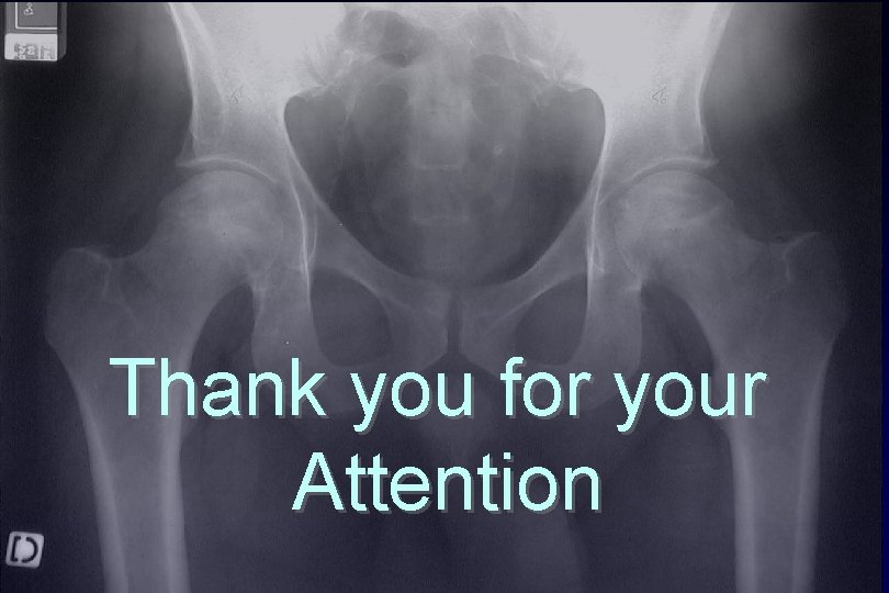 Thank you for your Attention 