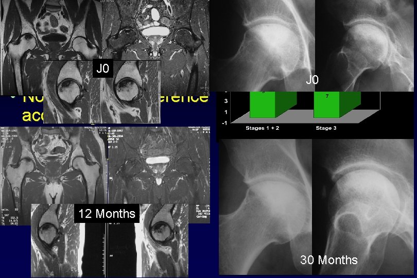 Results (3) J 0 • Seven clinical failures • No significant difference according to