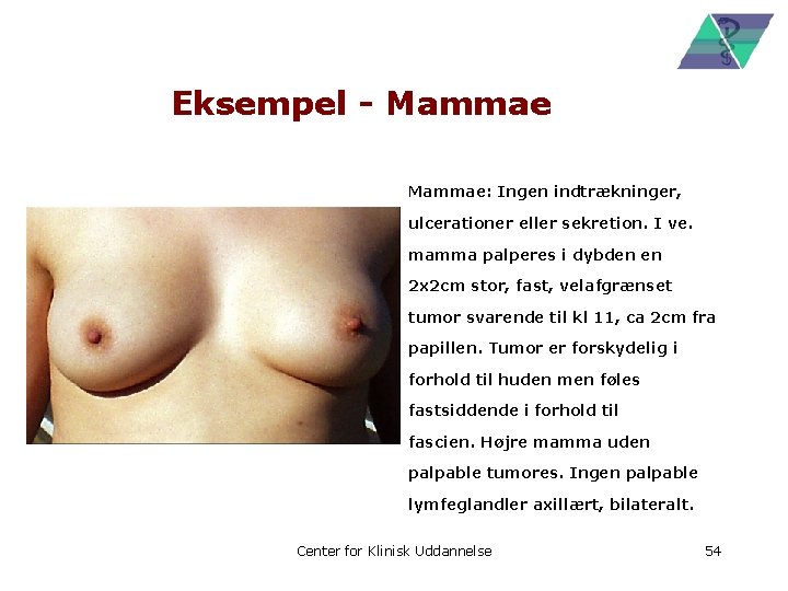 Eksempel - Mammae: Ingen indtrækninger, ulcerationer eller sekretion. I ve. mamma palperes i dybden