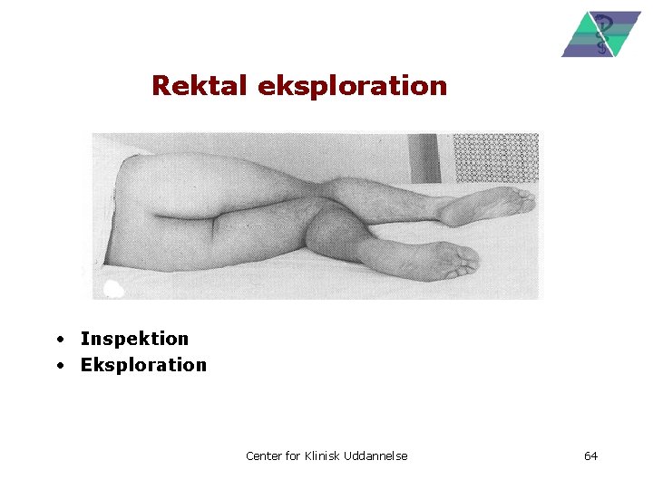 Rektal eksploration • Inspektion • Eksploration Center for Klinisk Uddannelse 64 