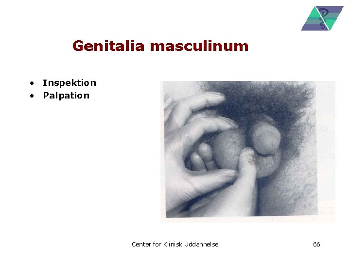 Genitalia masculinum • Inspektion • Palpation Center for Klinisk Uddannelse 66 