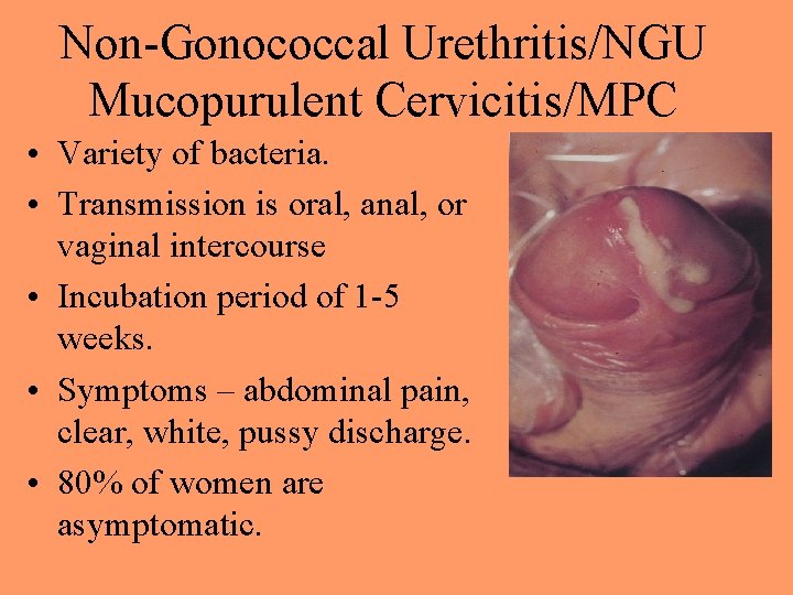 Non-Gonococcal Urethritis/NGU Mucopurulent Cervicitis/MPC • Variety of bacteria. • Transmission is oral, anal, or