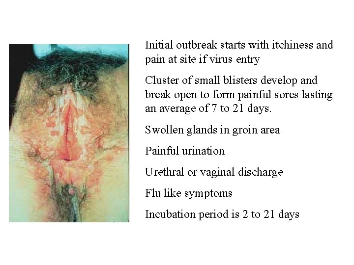 Initial outbreak starts with itchiness and pain at site if virus entry Cluster of