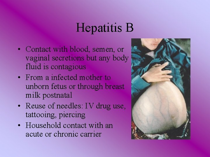 Hepatitis B • Contact with blood, semen, or vaginal secretions but any body fluid