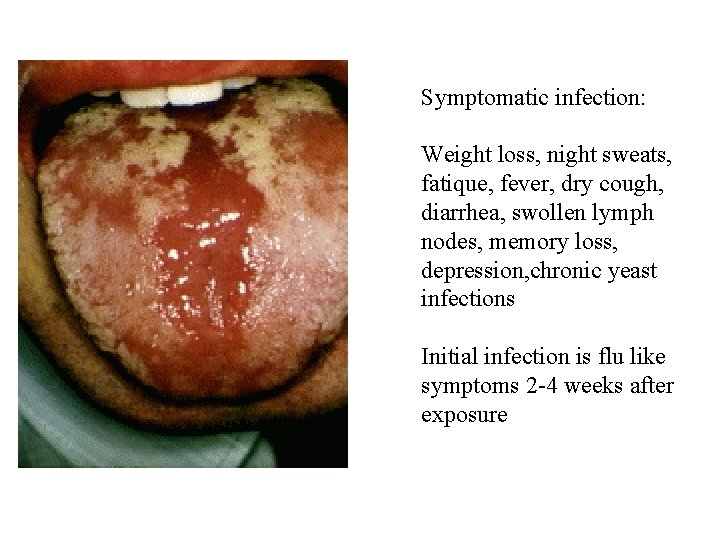 Symptomatic infection: Weight loss, night sweats, fatique, fever, dry cough, diarrhea, swollen lymph nodes,