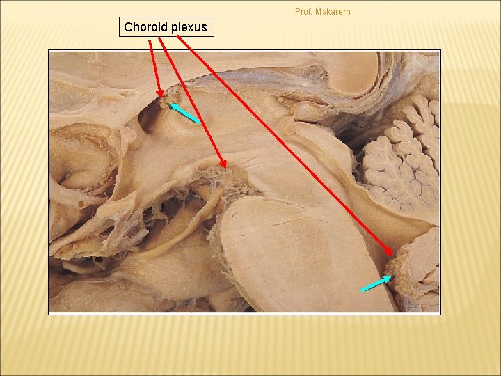 Prof. Makarem Choroid plexus 