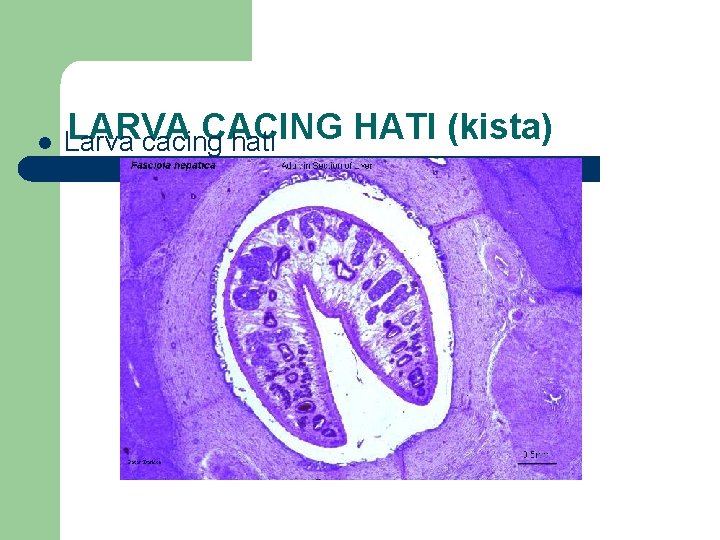 l LARVA CACING Larva cacing hati HATI (kista) 