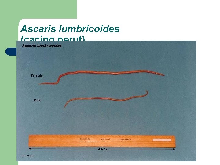 Ascaris lumbricoides (cacing perut) 