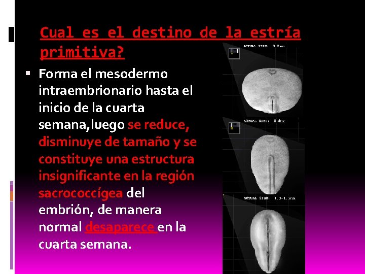 Cual es el destino de la estría primitiva? Forma el mesodermo intraembrionario hasta el