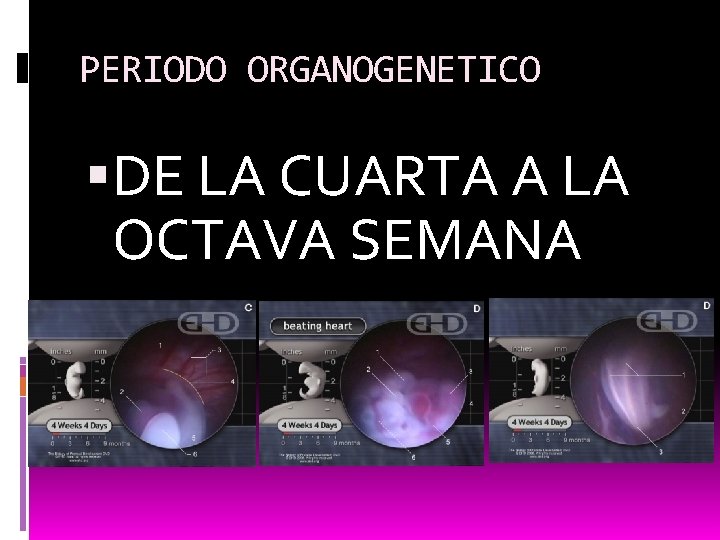 PERIODO ORGANOGENETICO DE LA CUARTA A LA OCTAVA SEMANA 