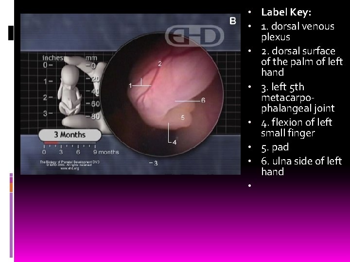  • Label Key: • 1. dorsal venous plexus • 2. dorsal surface of