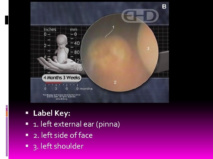  Label Key: 1. left external ear (pinna) 2. left side of face 3.
