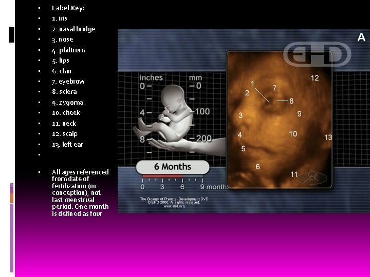  • • • • Label Key: 1. iris 2. nasal bridge 3. nose