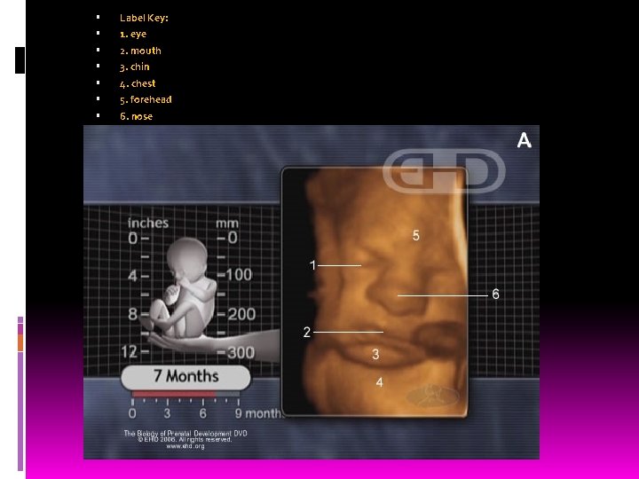  Label Key: 1. eye 2. mouth 3. chin 4. chest 5. forehead 6.