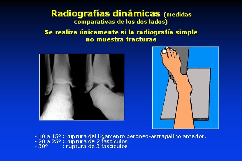 Radiografías dinámicas (medidas comparativas de los dos lados) Se realiza únicamente si la radiografía