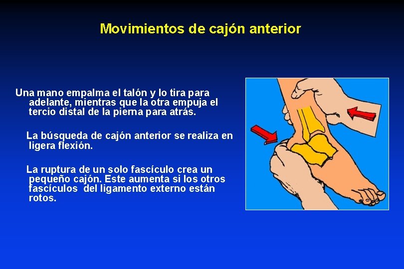 Movimientos de cajón anterior Una mano empalma el talón y lo tira para adelante,