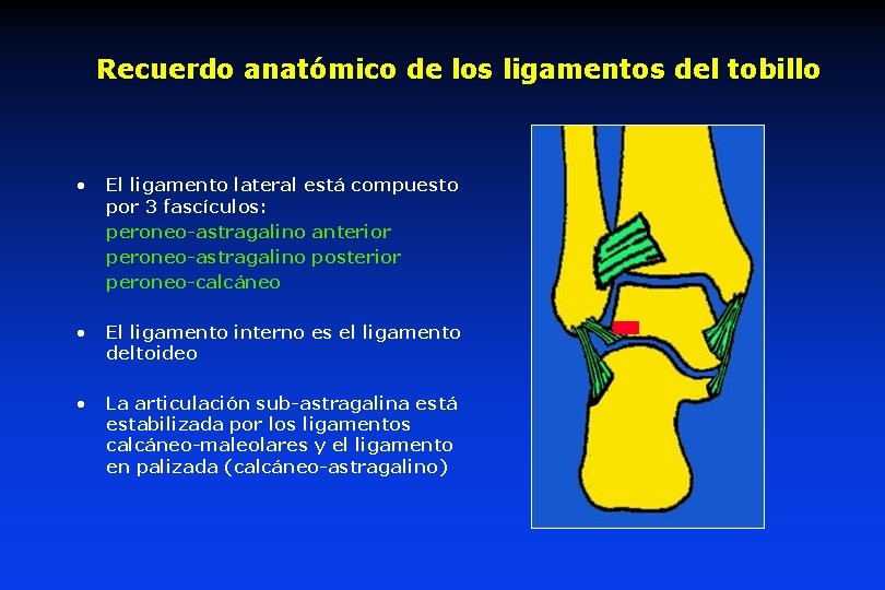 Recuerdo anatómico de los ligamentos del tobillo • El ligamento lateral está compuesto por