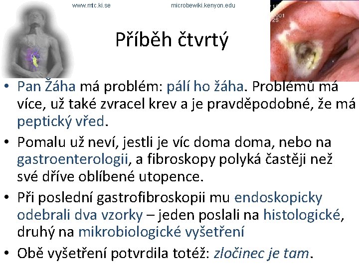 www. mtc. ki. se microbewiki. kenyon. edu Příběh čtvrtý • Pan Žáha má problém: