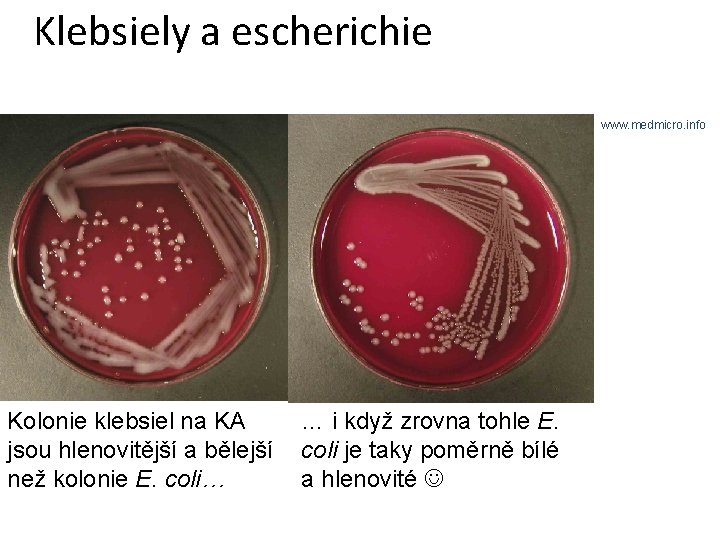 Klebsiely a escherichie www. medmicro. info Kolonie klebsiel na KA … i když zrovna