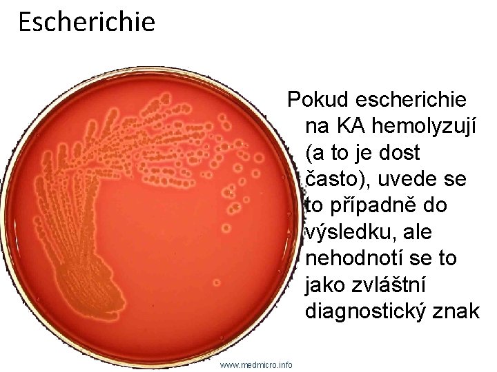Escherichie Pokud escherichie na KA hemolyzují (a to je dost často), uvede se to