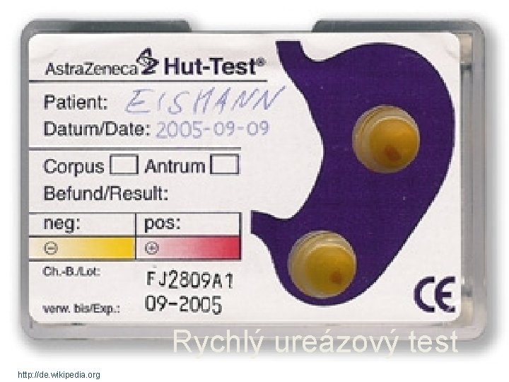 Rychlý ureázový test http: //de. wikipedia. org 