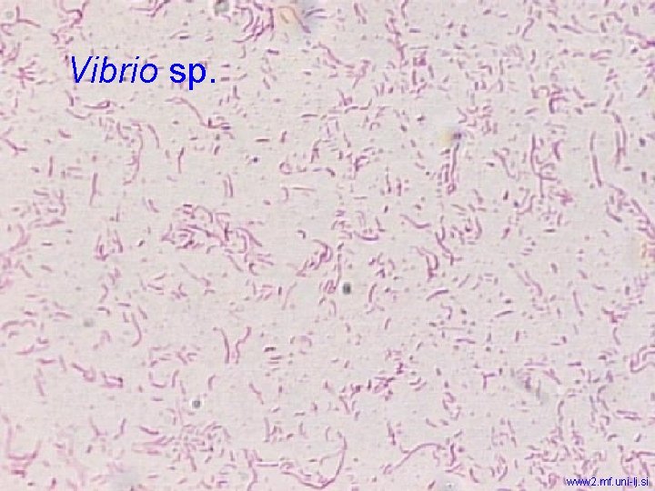 Vibrio sp. www 2. mf. uni-lj. si 