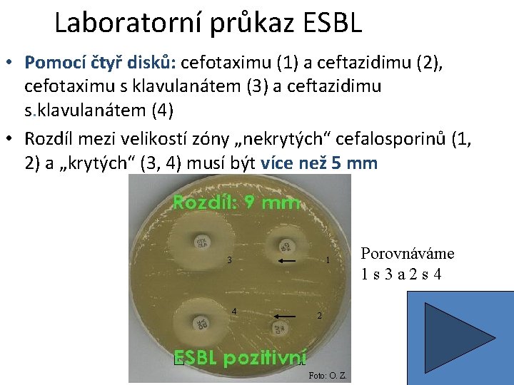 Laboratorní průkaz ESBL • Pomocí čtyř disků: cefotaximu (1) a ceftazidimu (2), cefotaximu s