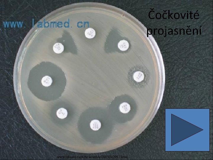 Čočkovité projasnění www. labmed. cn/Article/wshw/200509/2992. html 